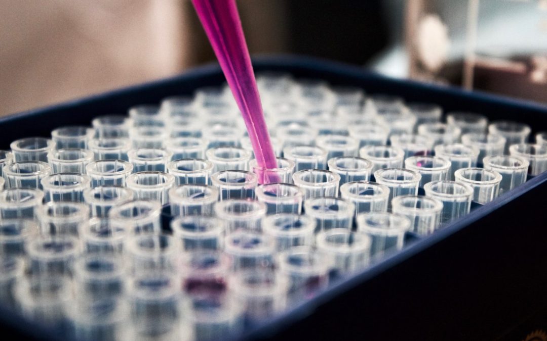 Hair Follicle Test: Most Efficient and Effective Test for Drugs Usage